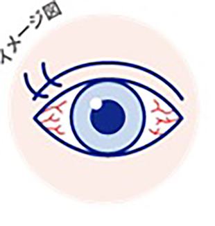 結膜充血イメージ