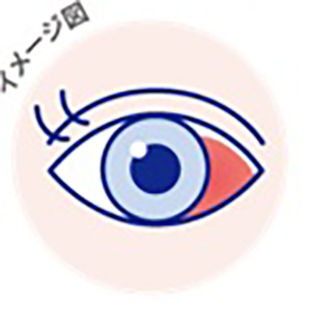結膜下出血イメージ